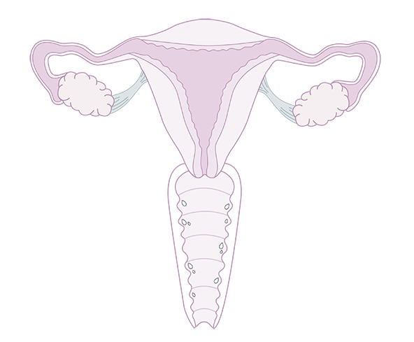 vagin transsudation illustration secheresse vaginale