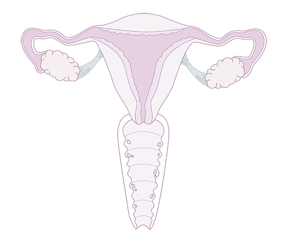 Illustration vagin transsudation - Secheresse vaginale